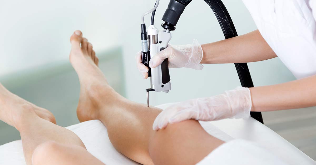Laser hair removal treatment for men using advanced medical-grade laser technology
