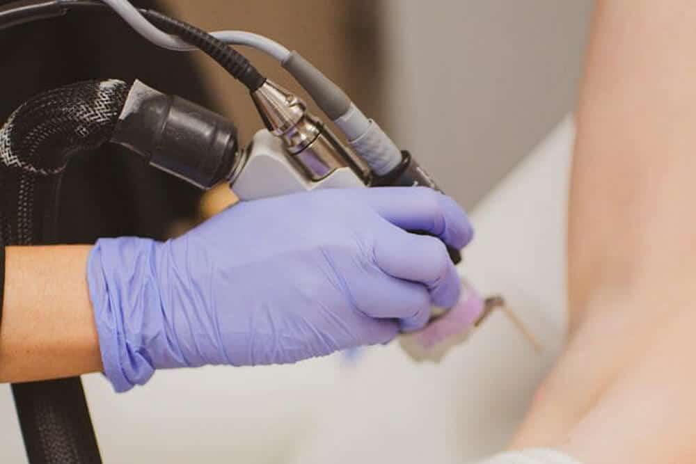 Medical-grade laser hair removal treatment using advanced technology