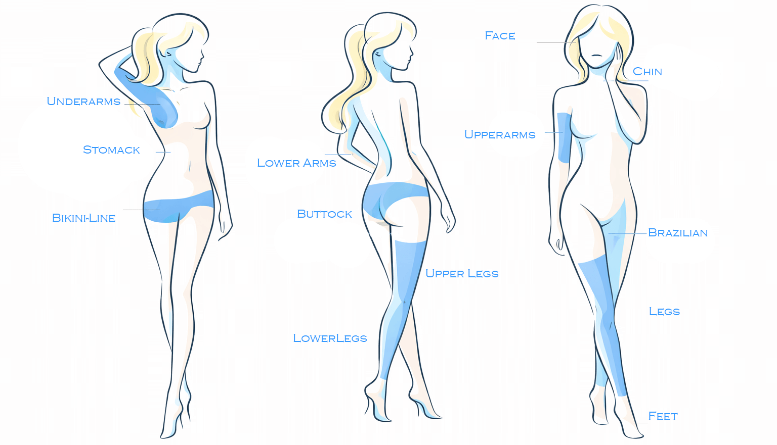 Stylized illustration of three female figures showing common laser hair removal treatment areas including underarms, bikini area, legs, arms, and face.