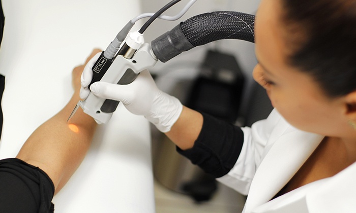 Cynosure Elite laser handpiece used for professional hair removal at Athens