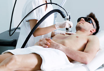 Male client receiving professional laser hair removal on his torso